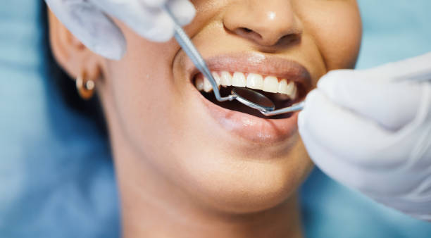 Best Dental Abscess Treatment in Wellton, AZ